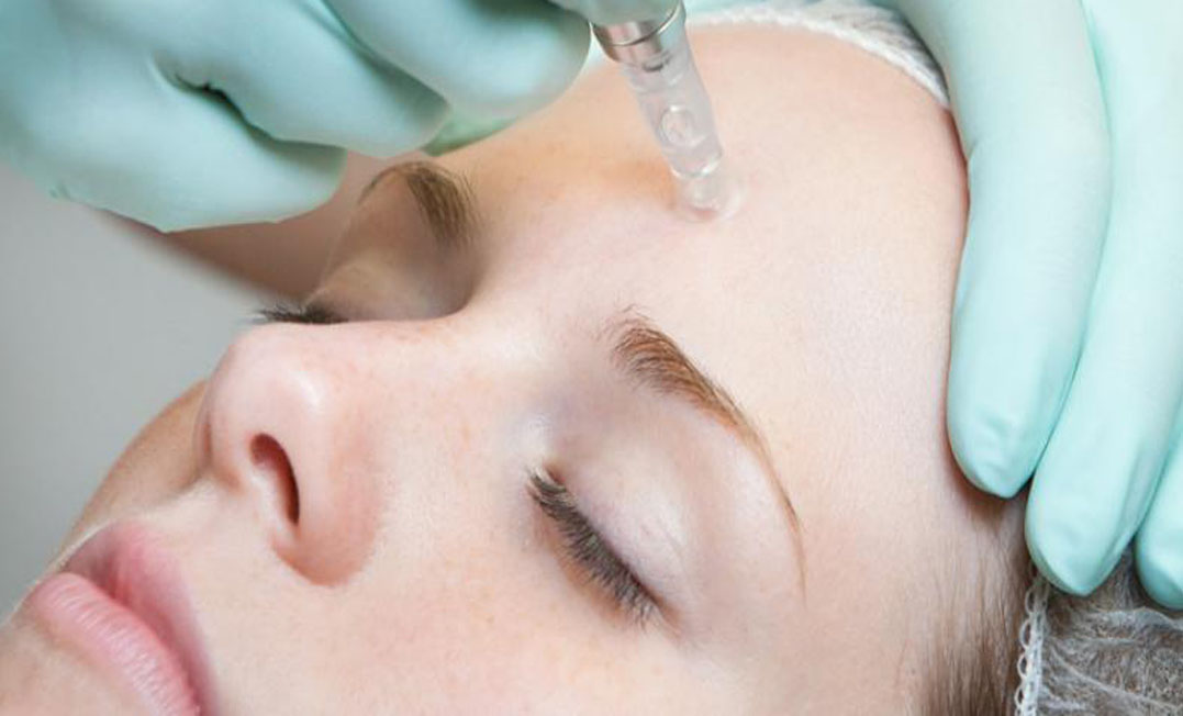 مزوتراپی بیت